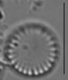 Cyclotella atomus LM6