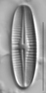 Achnanthidium rivulare LM3