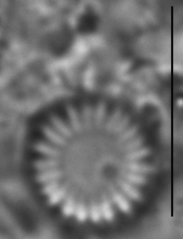 Cyclotella atomus LM9