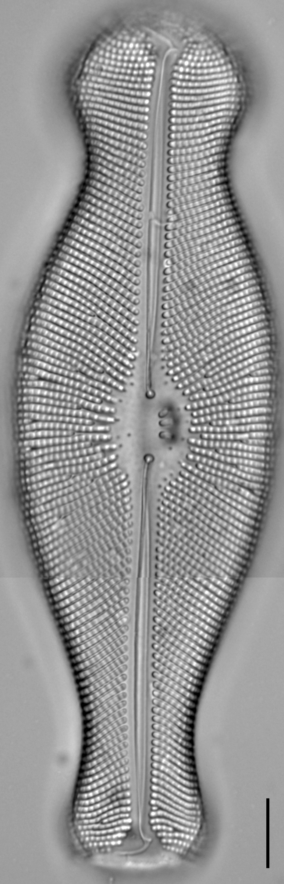 Didymosphenia geminata LM2