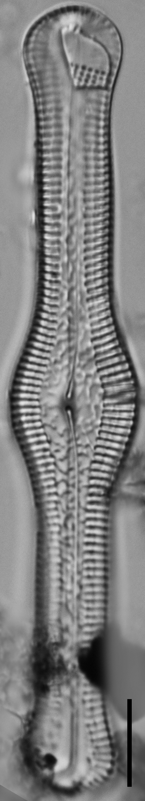 Pinnularia turgidula LM4