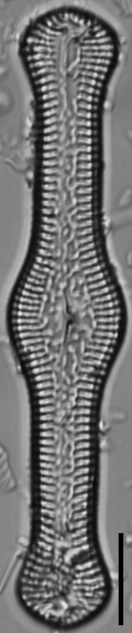 Pinnularia turgidula LM6