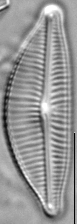 Encyonema hamsherae LM6