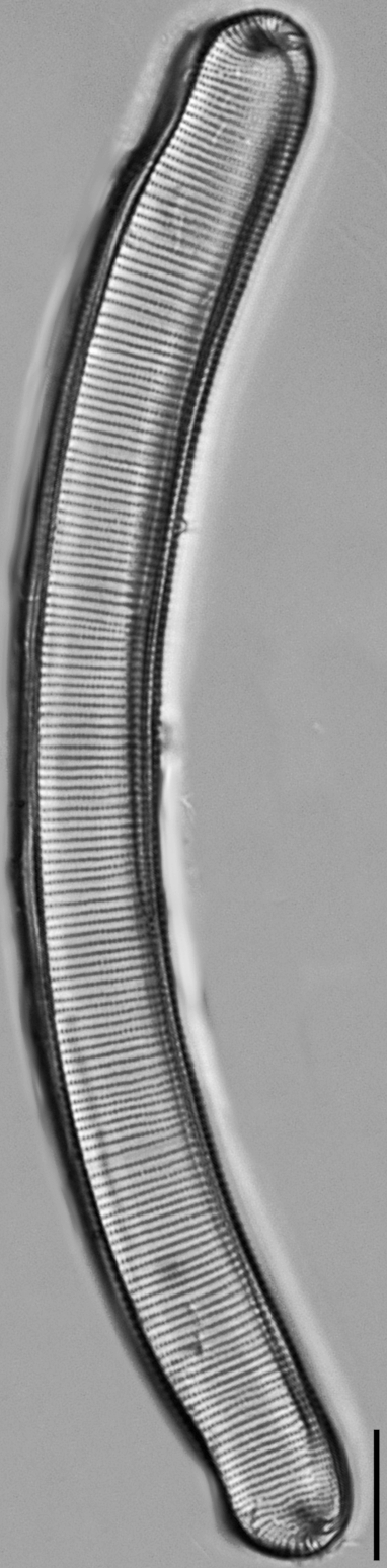 Eunotia pseudoparallela LM1