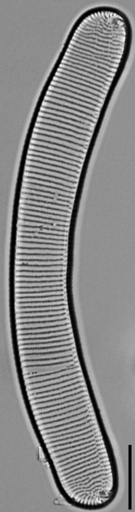 Eunotia pseudoparallela LM6