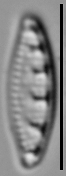 Stauroneis thermicola LM6