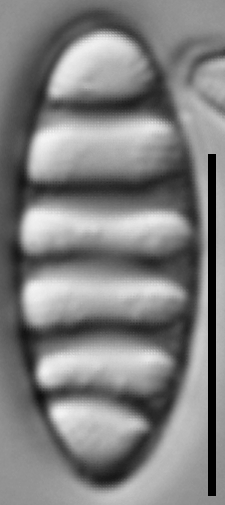 Tetracyclus rupestris LM2