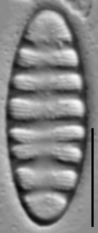 Tetracyclus rupestris LM4