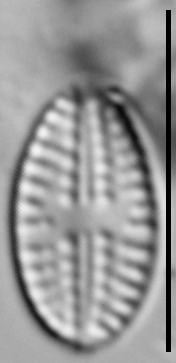 Eolimna metafarta LM4