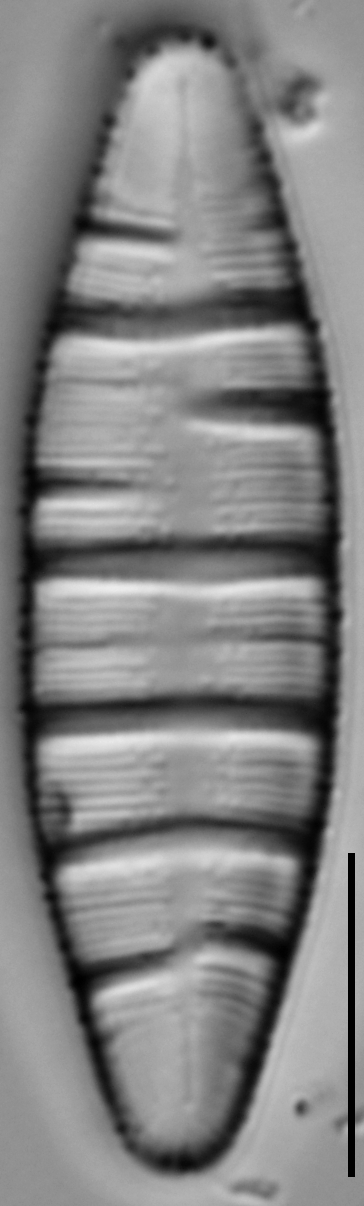 Odontidium hyemale LM1