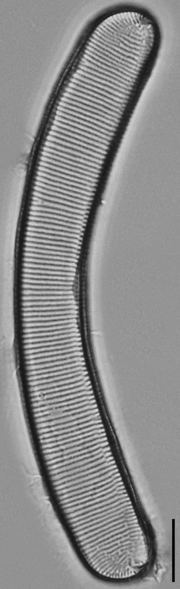 Eunotia pseudoparallela LM4