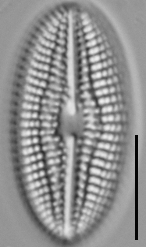 Diploneis abscondita LM5