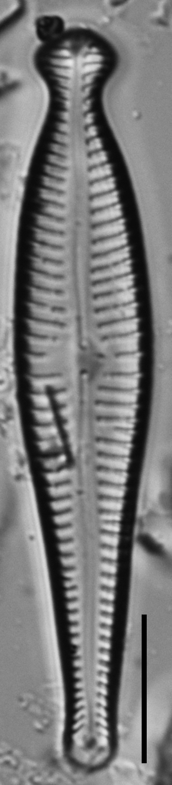 Gomphonema pseudosphaerophorum LM1