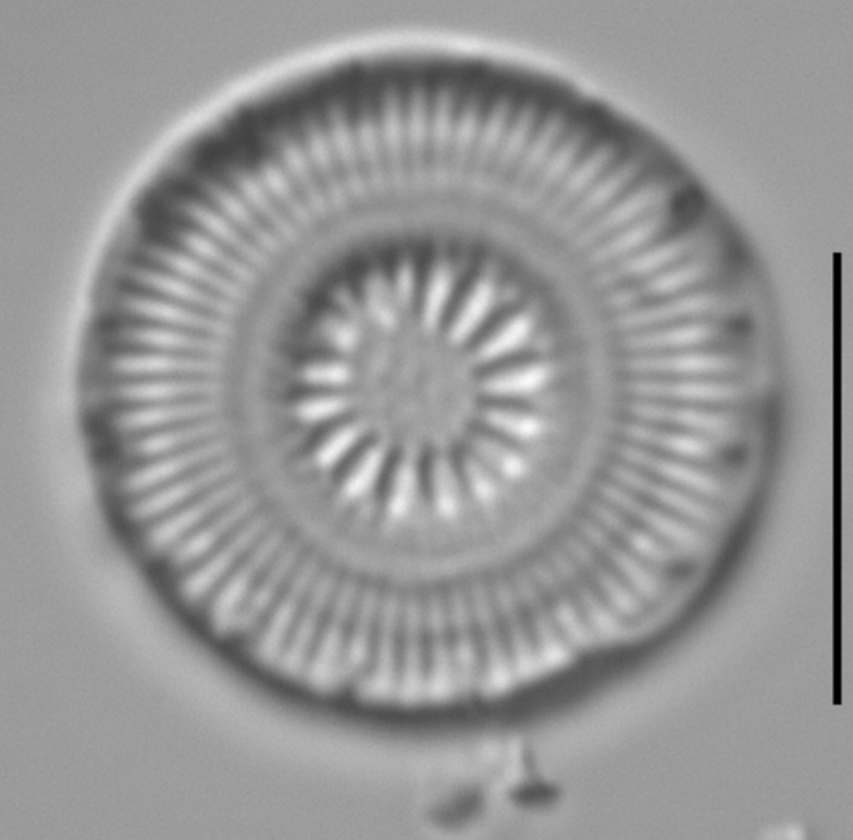 Discostella asterocostata LM6