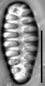 Staurosirella martyi LM10