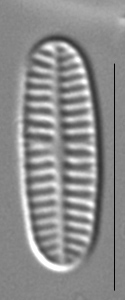 Rossithidium nodosum LM2