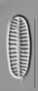 Rossithidium nodosum LM4