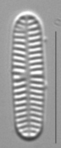 Rossithidium nodosum LM10