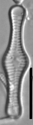 Tabellaria flocculosa LM4