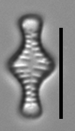 Tabellaria flocculosa LM6