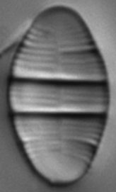 Odontidium mesodon LM5