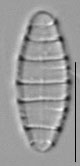 Diatoma moniliformis LM2