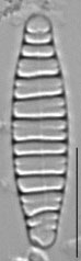 Diatoma moniliformis LM3