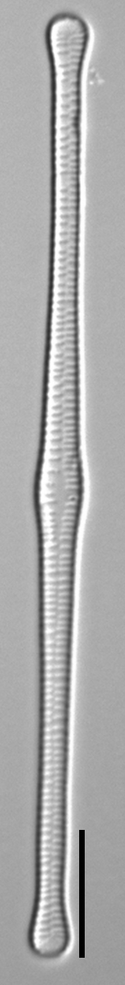 Tabellaria flocculosa LM7