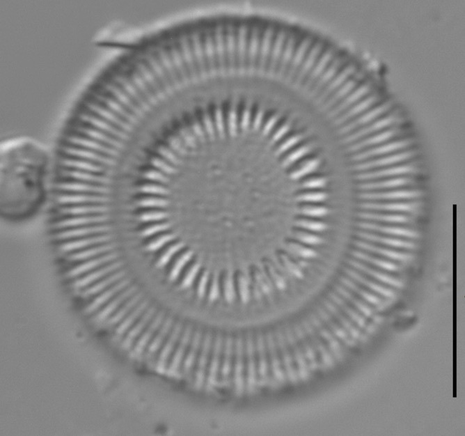 Discostella asterocostata LM4