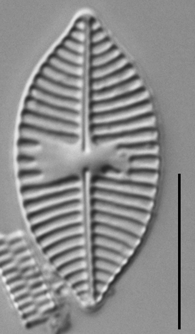 Planothidium lanceolatoide LM3