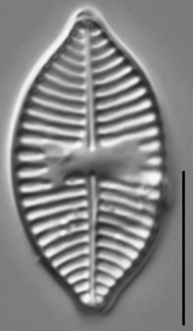 Planothidium lanceolatoide LM7