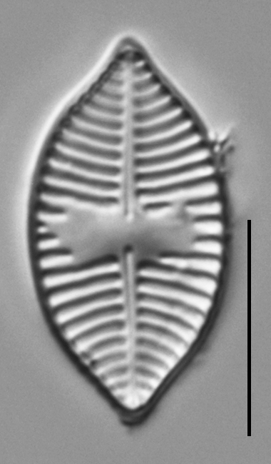 Planothidium lanceolatoide LM5