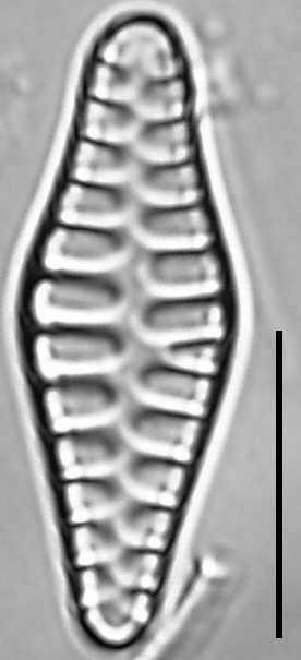 Staurosirella rhomboides LM2