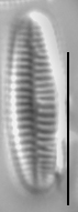 Achnanthidium atomus LM4