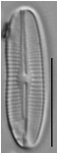 Achnanthidium crassum LM2