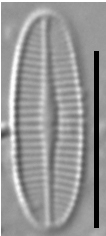 Achnanthidium crassum LM6