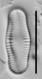 Achnanthidium Rosenstockii Vt10018 A 112117 72 C