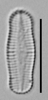 Achnanthidium Rosenstockii Vt10089 A 010418 05 C