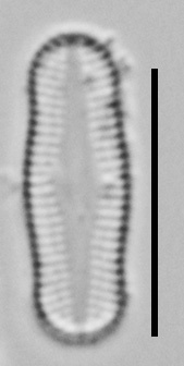 Achnanthidium Rosenstockii Vt10089 A 010418 07 C