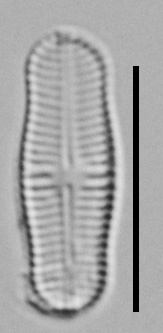 Achnanthidium Rosenstockii Vt10089 A 010418 11 C