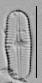 Achnanthidium Rosenstockii Vt10093 A 012618 02 C