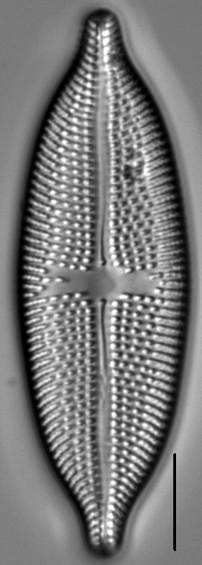 Aneumastus rostratus LM2