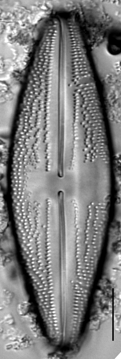 Anomoeoneis Costata LM5