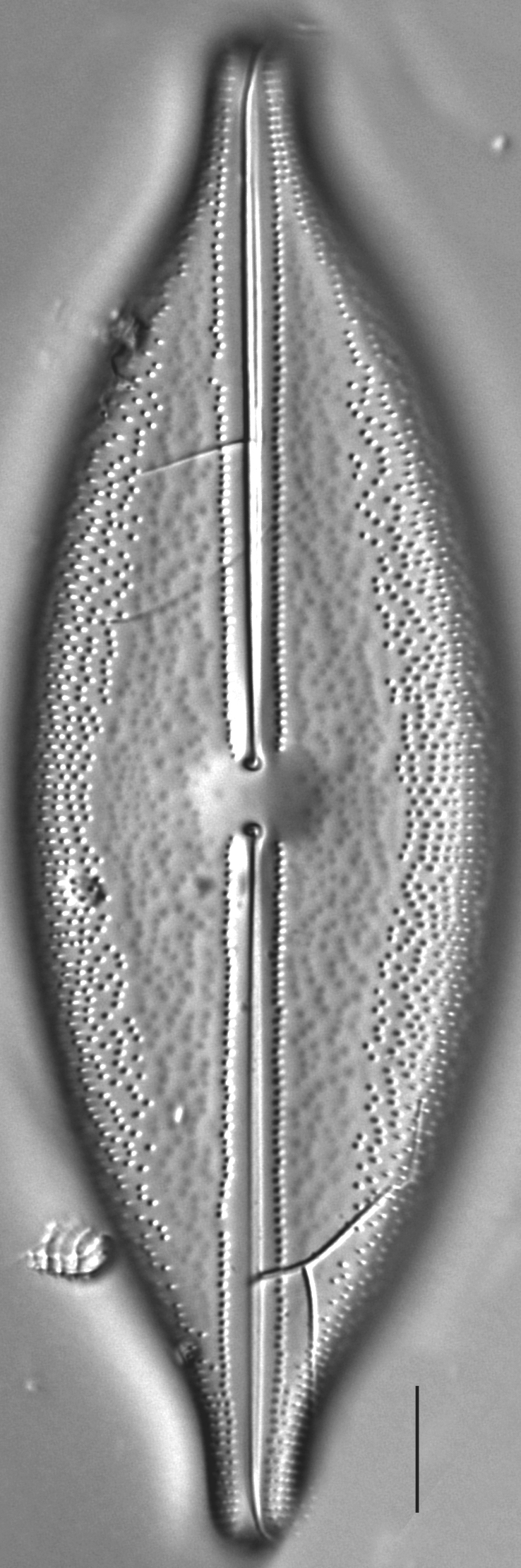 Anomoeoneis Sculpta LM1