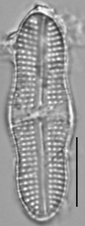 Achnanthes tumescens LM7