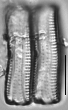 Achnanthes tumescens LM1