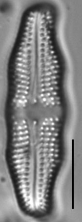 Achnanthes undulorostrata LM1