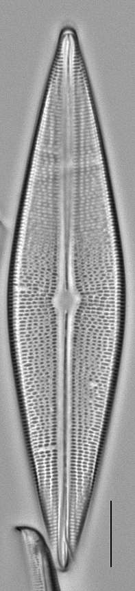 Brachysira serians LM3