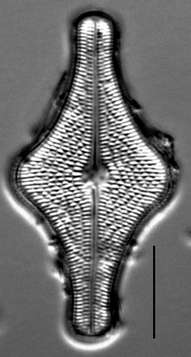 Brachysira follis LM5