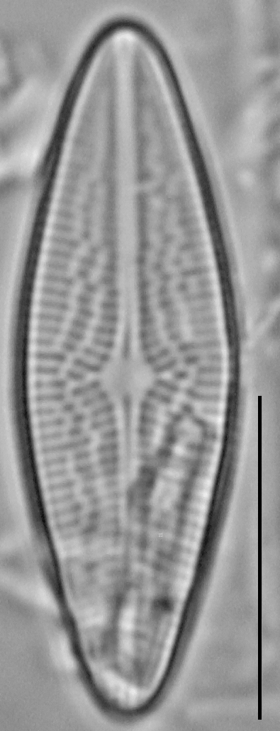 Brachysira brebissonii LM4